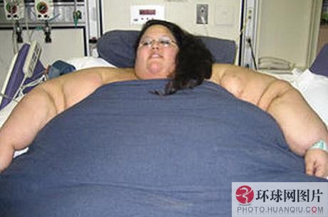 最瘦的图片_世界最瘦女子讲述减肥危害 控制饮食曾得厌食症