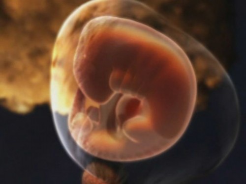 怀孕2个月胎儿图片图片